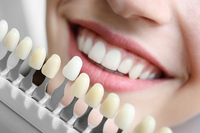 Everything about dental implants and maintenance