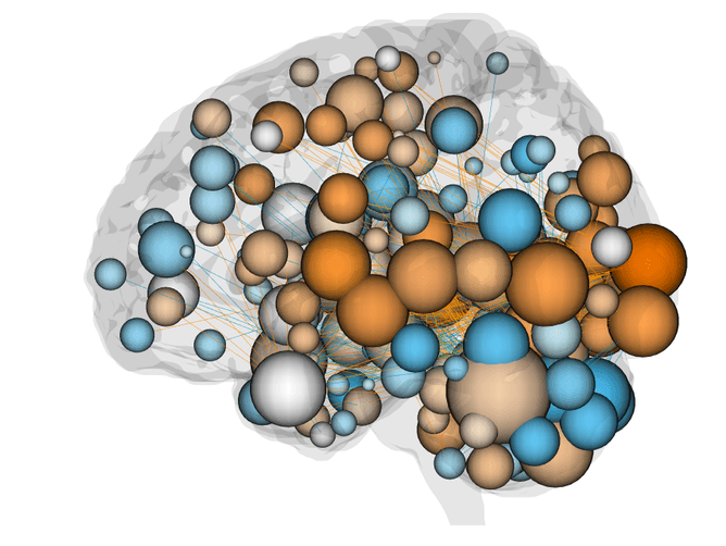  Spheres represent regions of the brain and lines show the connections between them. The size of the spheres corresponds to the number of connections they have. Orange spheres have more connections in the network that predicts better attention, blue spheres have more connections in the network that predicts worse attention, and gray spheres have an approximately equal number of connections in each. Monica Rosenberg, CC BY-ND 